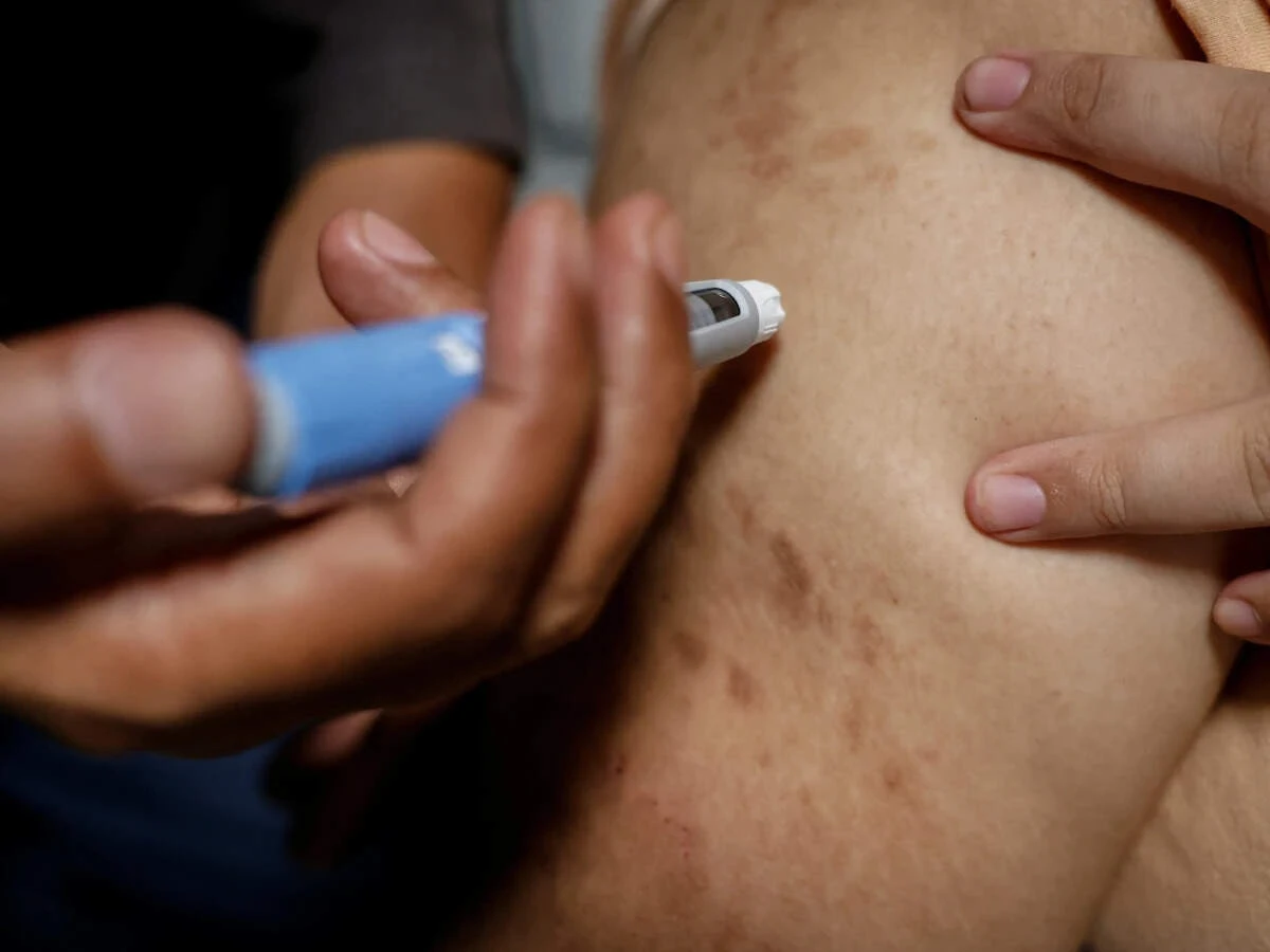 Beauty firms chase 'Ozempic face' market as weight-loss drugs boom